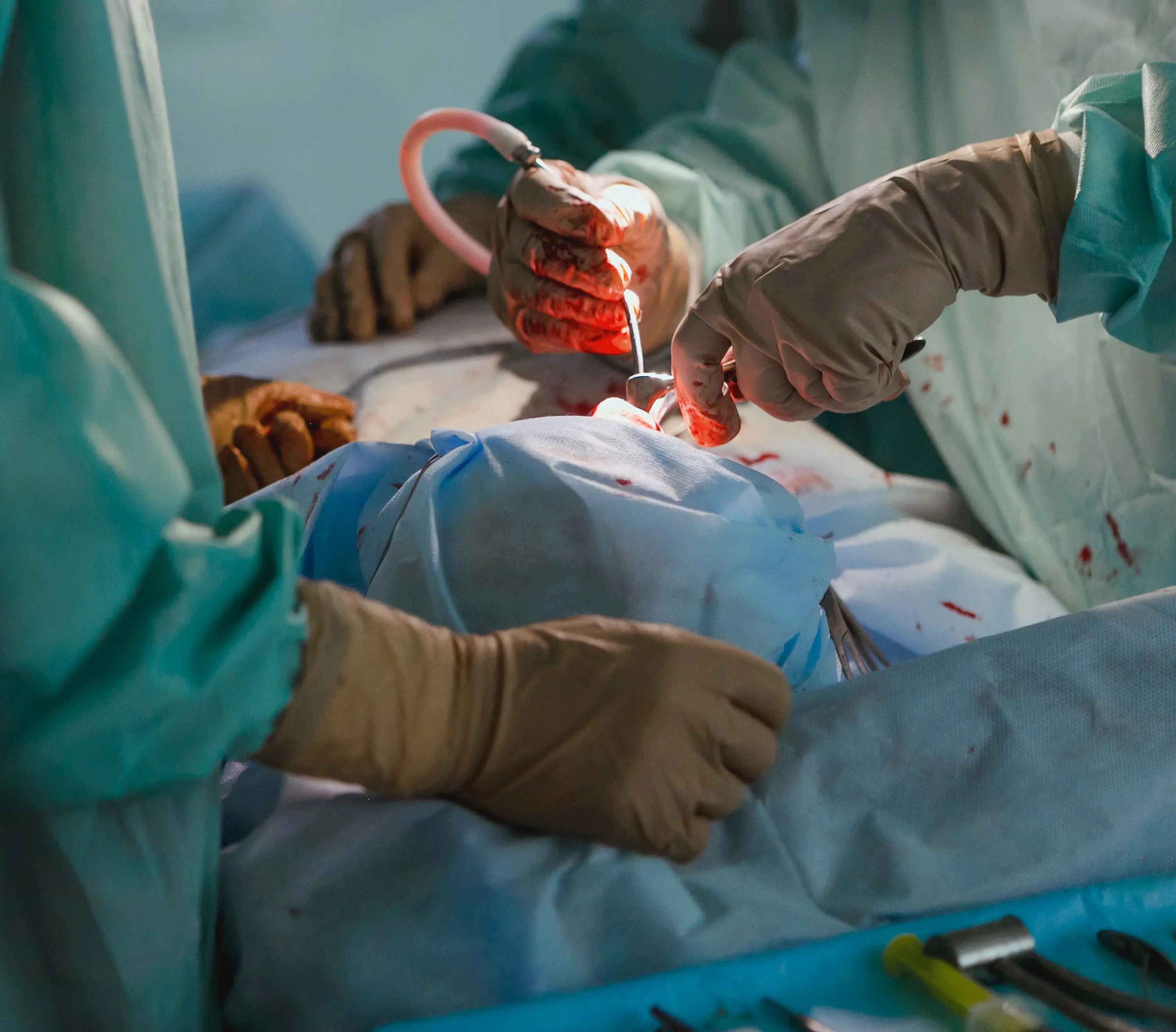 Surgeons performing a medical operation, close-up.