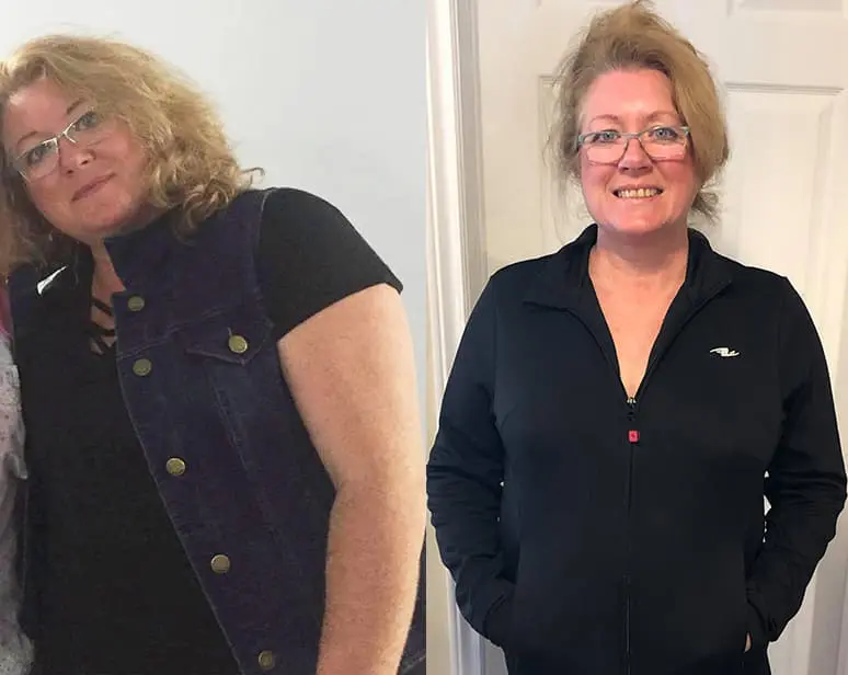 Woman before and after weight loss transformation.