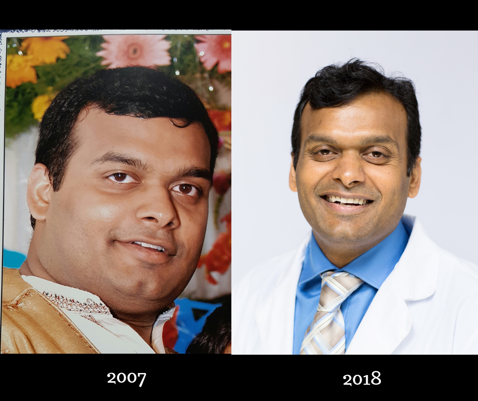 My-before-and-after
