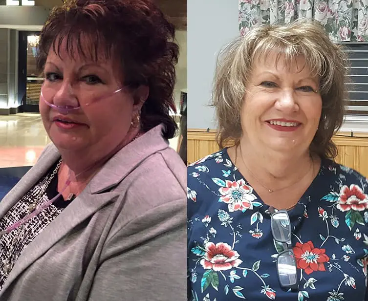 Two photos of the same smiling woman.